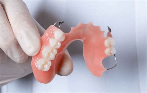 glue to repair the metal bracket on my dental partial|partial denture adhesive reviews.